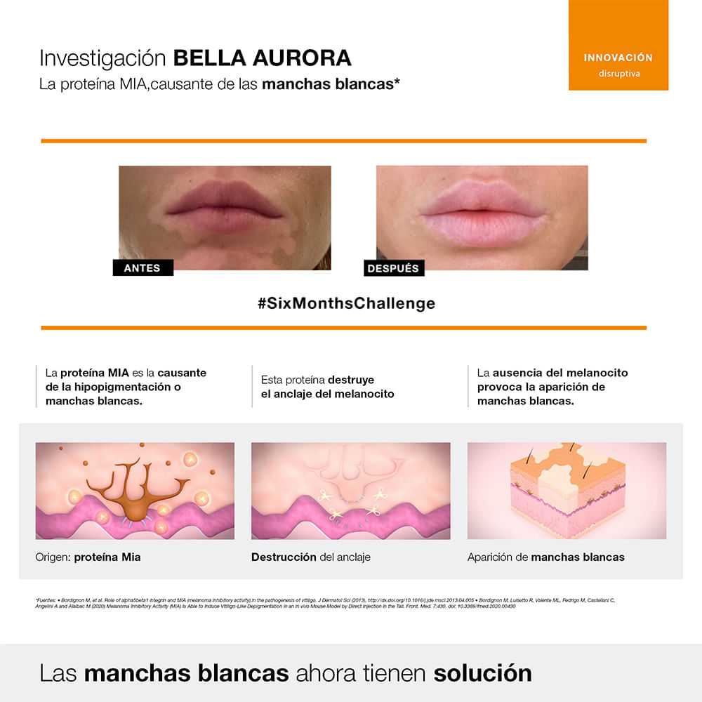 Repigment12 Crema Reguladora De La Pigmentación Cutánea - Bella Aurora img #3