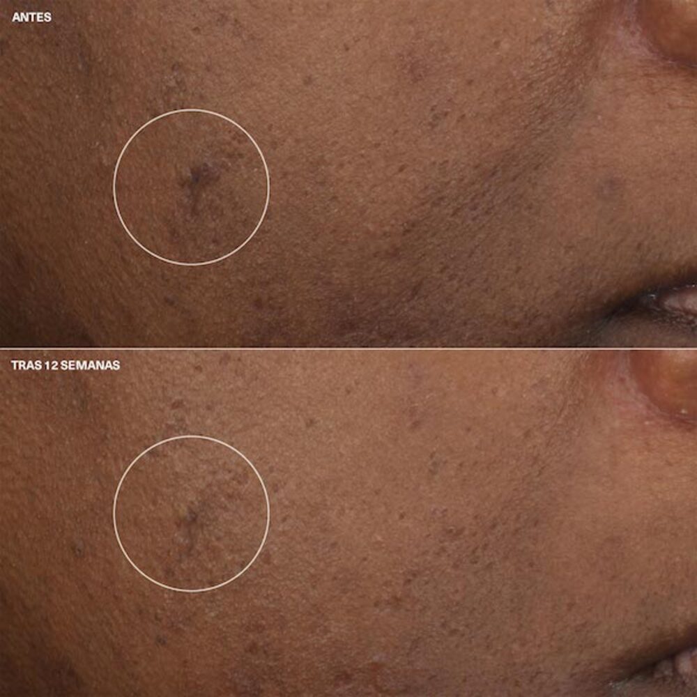 Even Better Clinical Brightening Moisturizer - Clinique img #4