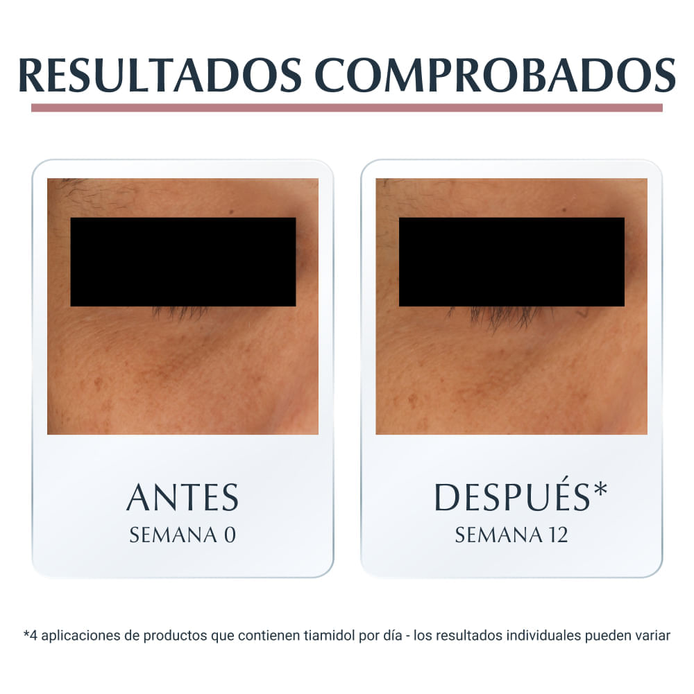 Anti Pigment Contorno De Ojos - Eucerin® img #5