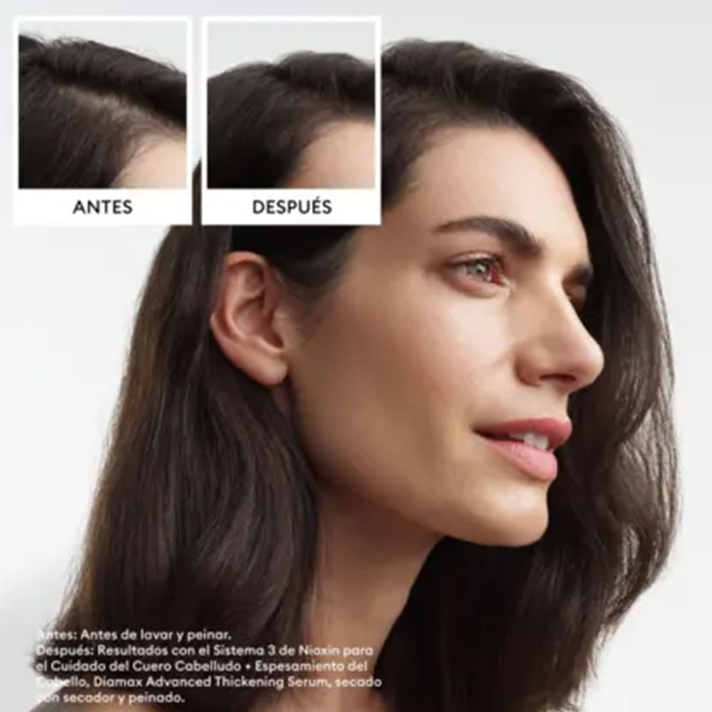 Tratamiento Para Adelgazamiento Y Caída Capilar Sistema 3 - Nioxin img #3