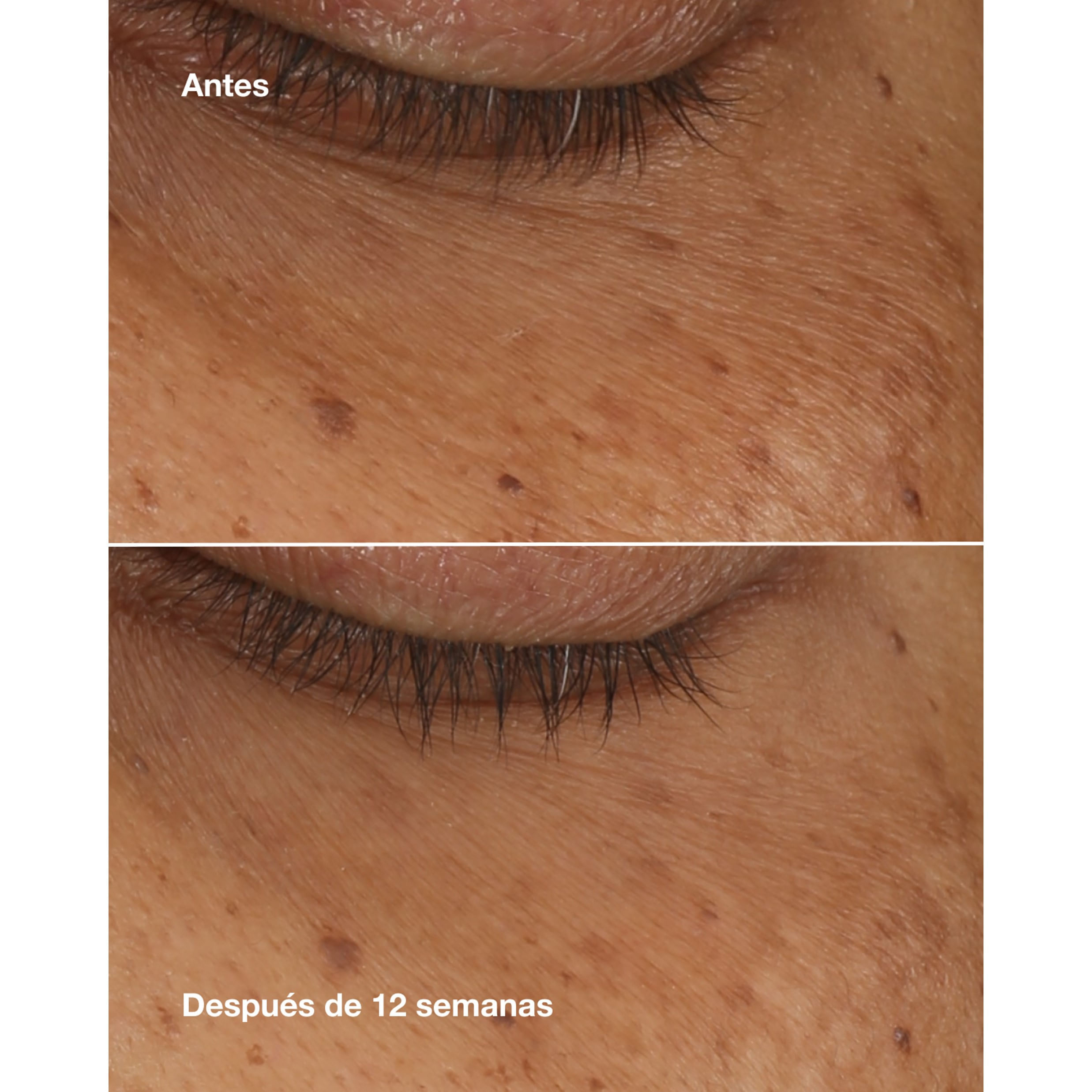 Concentrado de Suero para el Contorno de Ojos All About Eyes Brightening Serum Concentrate - Clinique img #3