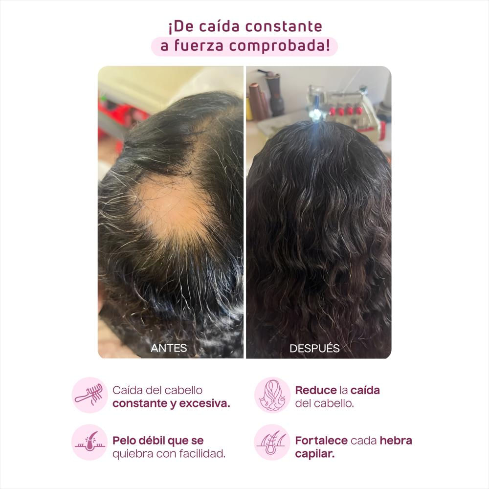 Shampoo De Cebolla Kaba img #3