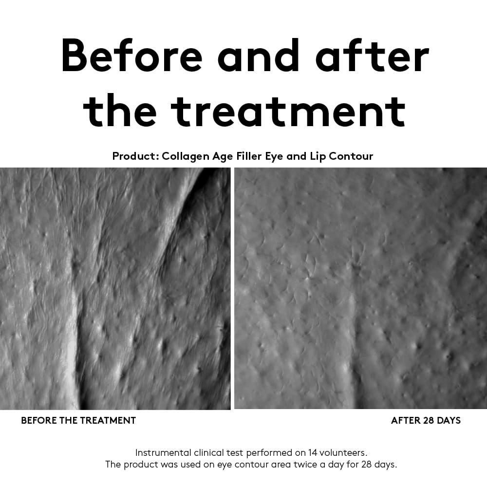 Contorno de Ojos Y Labios con Colágeno Age Filler - Korff img #3
