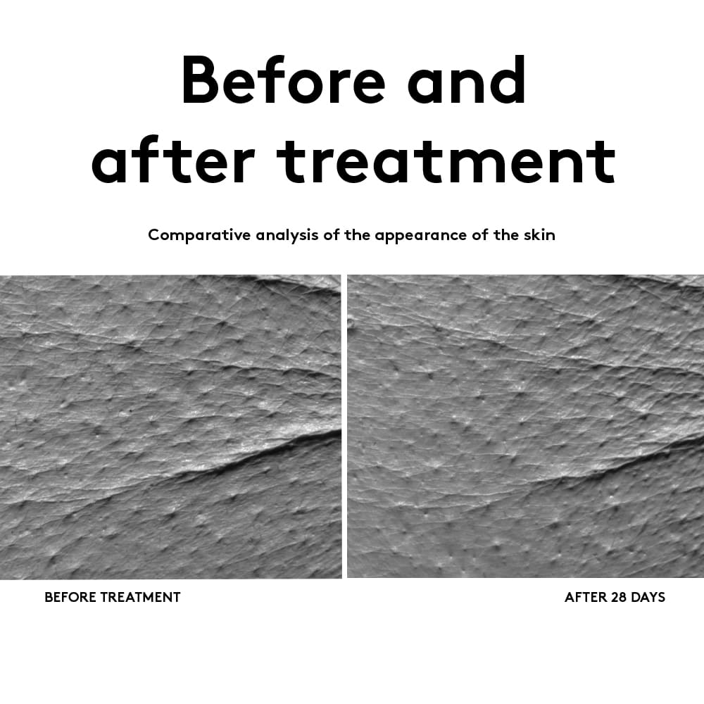 Contorno De Ojos Antiedad EYE Zone - Korff img #3