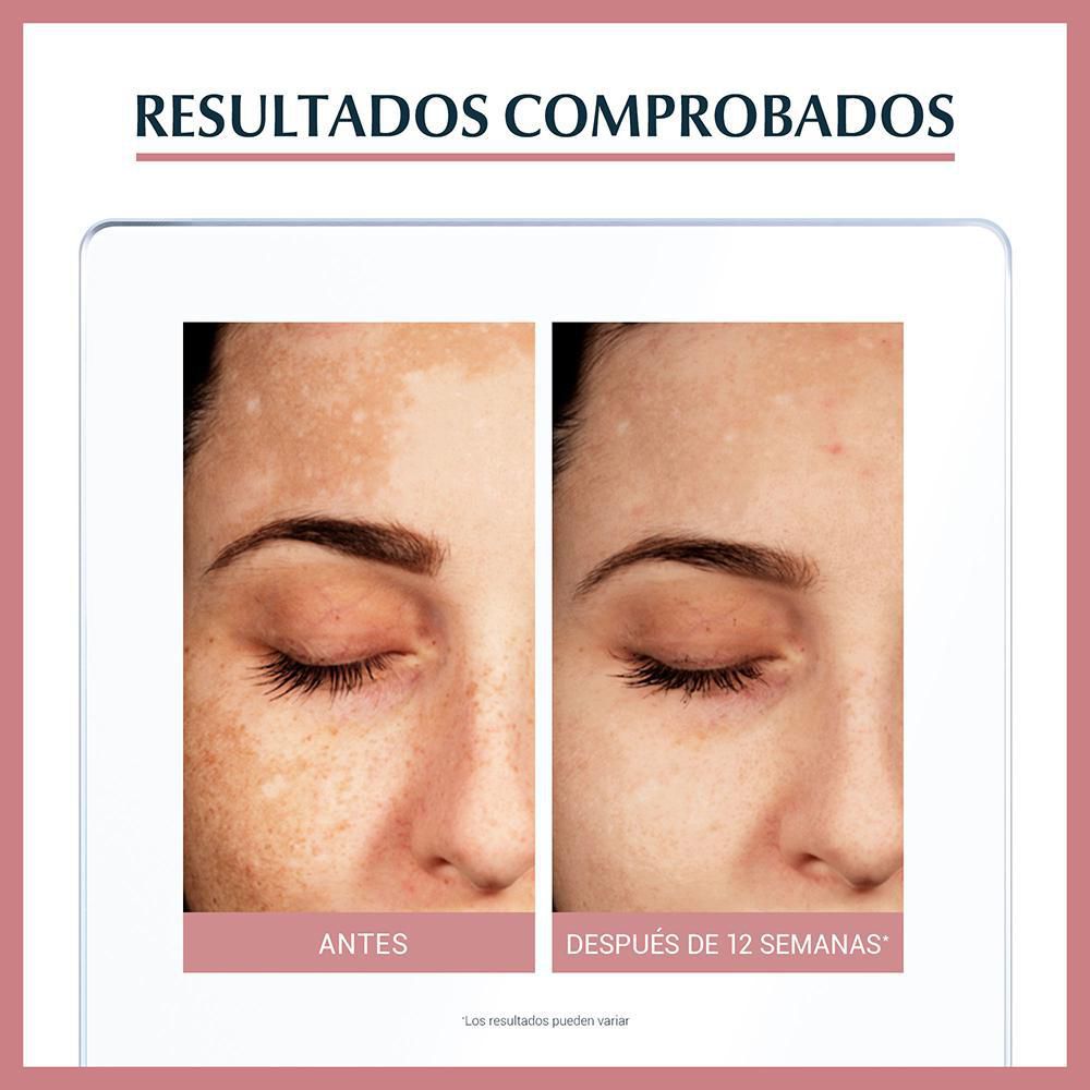 Sérum EUCERIN antimanchas antipigment dual (30  ml) img #4